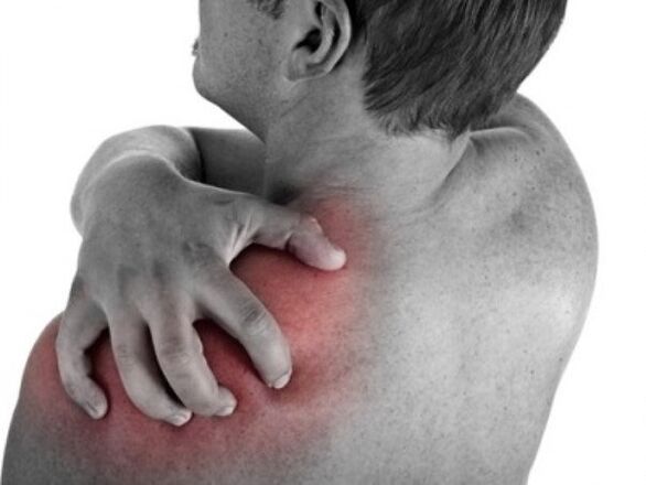 Pain in the shoulder joint due to arthrosis