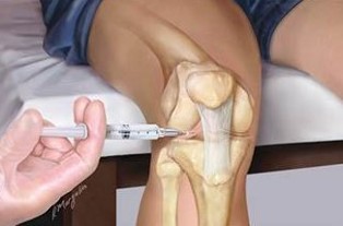 The injection also