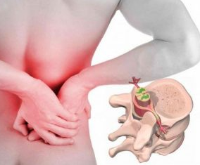 Lumbago at the beginning of the disease, osteochondrosis