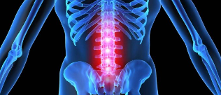 The deformation of the intervertebral disc