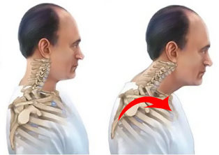 the healthy and the sick, of the spinal column